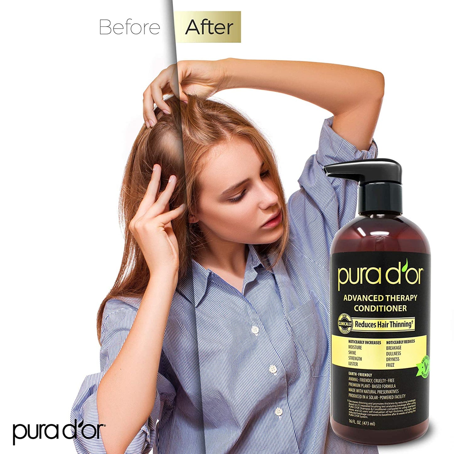 PURA D'OR Advanced Therapy Conditioner (16oz) For Increased Moisture, Strength, Volume & Texture, No Sulfates, Made with Argan Oil & Biotin, All Hair Types, Men & Women (Packaging May Vary) - Hatke