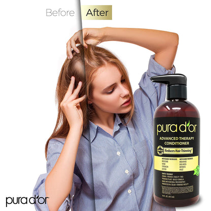 PURA D'OR Advanced Therapy Conditioner (16oz) For Increased Moisture, Strength, Volume & Texture, No Sulfates, Made with Argan Oil & Biotin, All Hair Types, Men & Women (Packaging May Vary) - Hatke